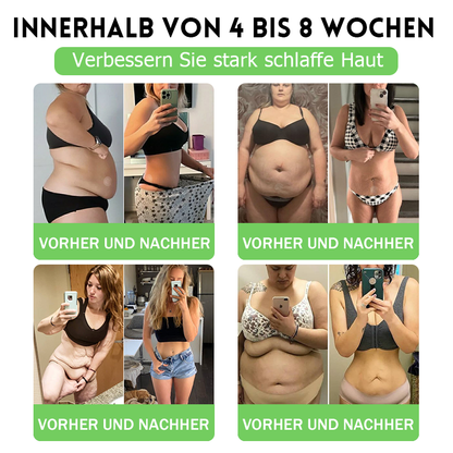 🇩🇪𝑨𝑴𝒁𝑲𝑬𝑬𝑷® 𝑵𝒂𝒏𝒐 𝑴𝒊𝒄𝒓𝒐𝒏𝒆𝒆𝒅𝒍𝒆 𝑷𝒂𝒕𝒄𝒉 (𝑵𝒖𝒓 𝒆𝒊𝒏𝒎𝒂𝒍 𝒕ä𝒈𝒍𝒊𝒄𝒉 — 𝒔𝒊𝒄𝒉𝒕𝒃𝒂𝒓𝒆 𝑽𝒆𝒓ä𝒏𝒅𝒆𝒓𝒖𝒏𝒈𝒆𝒏 𝒊𝒏 7 𝑻𝒂𝒈𝒆𝒏) 𝑭𝒐𝒓𝒎𝒆𝒍 ✅ 𝑼𝒏𝒕𝒆𝒓𝒔𝒕ü𝒕𝒛𝒕 𝑺𝒕𝒐𝒇𝒇𝒘𝒆𝒄𝒉𝒔𝒆𝒍, 𝑮𝒆𝒘𝒊𝒄𝒉𝒕𝒔𝒎𝒂𝒏𝒂𝒈𝒆𝒎𝒆𝒏𝒕, 𝑯𝒆𝒓𝒛𝒈𝒆𝒔𝒖𝒏𝒅𝒉𝒆𝒊𝒕 𝒔𝒐𝒘𝒊𝒆 𝒃𝒆𝒊 𝑭𝒆𝒕𝒕𝒍𝒆𝒊𝒃𝒊𝒈𝒌𝒆𝒊𝒕, 𝒆𝒓𝒔𝒄𝒉𝒍𝒂𝒇𝒇𝒕𝒆𝒓 𝑯𝒂𝒖𝒕, 𝑫𝒊𝒂𝒃𝒆𝒕𝒆𝒔, 𝑺𝒄𝒉𝒍𝒂𝒇𝒂𝒑𝒏𝒐𝒆 𝒖𝒏𝒅 𝑮𝒆𝒍𝒆𝒏𝒌𝒑𝒓𝒐𝒃𝒍𝒆𝒎𝒆𝒏.